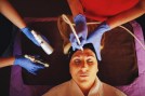 microdermabrasion