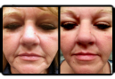 mderm-faces.png